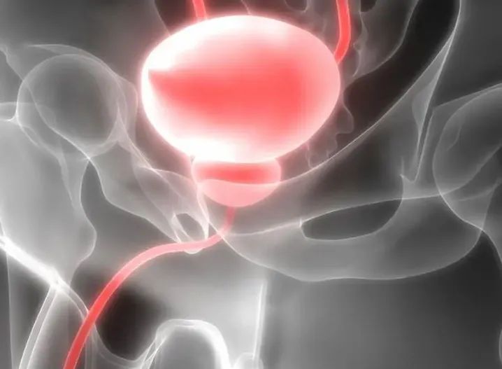 Nghiên cứu mới mang lại nhiều hy vọng cho bệnh nhân ung thư tuyến tiền liệt. Ảnh: CN