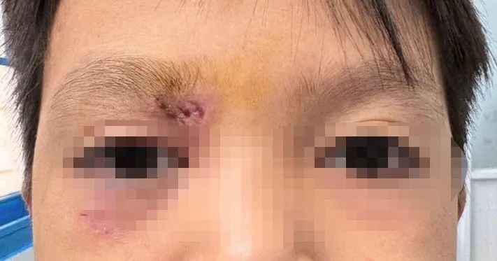 Bệnh nhi đã qua cơn nguy hiểm Bệnh nhi đã qua cơn nguy hiểm