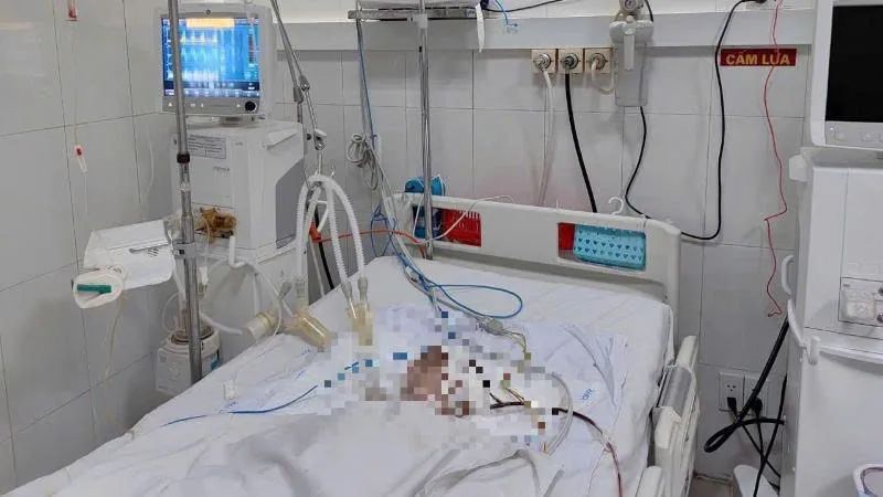 Có 3 trường hợp chấn thương nặng, trong đó có 1 bệnh nhân mới 11 tháng tuổi