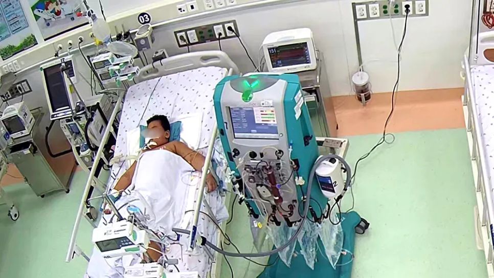 Bệnh nhi 7 tuổi được hồi sức tích cực tại Bệnh viện Nhi đồng 1 TPHCM
