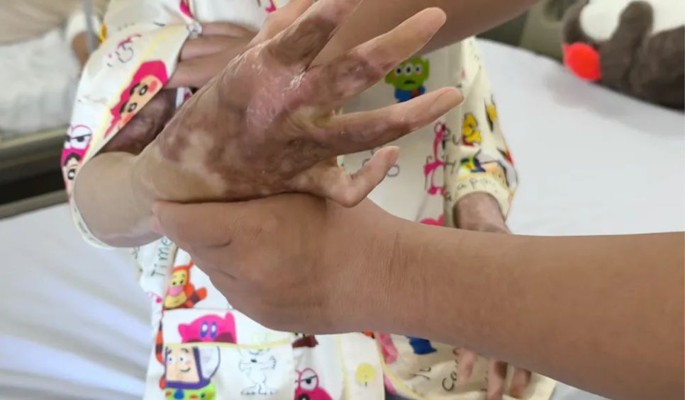 Bác sĩ kiểm tra lại vết thương cho nữ sinh trước ngày xuất viện Bác sĩ kiểm tra lại vết thương cho nữ sinh trước ngày xuất viện