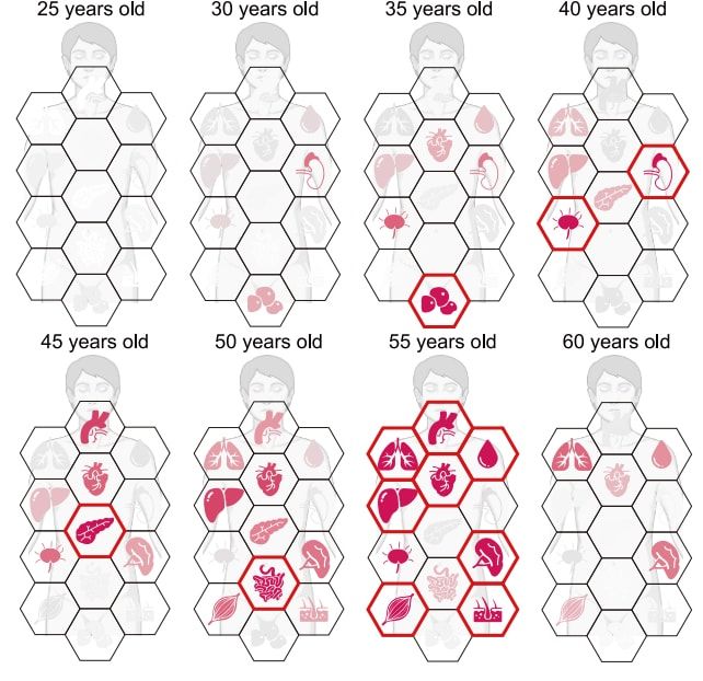Các cơ quan trong cơ thể bạn tùy theo thời điểm trở nên nhạy cảm nhất với lão hóa.