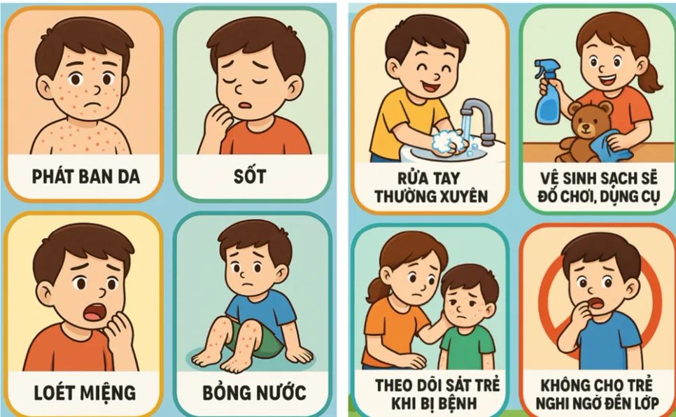 TPHCM: Ca mắc tay chân miệng tăng mạnh, nguy cơ bùng phát dịch do EV71