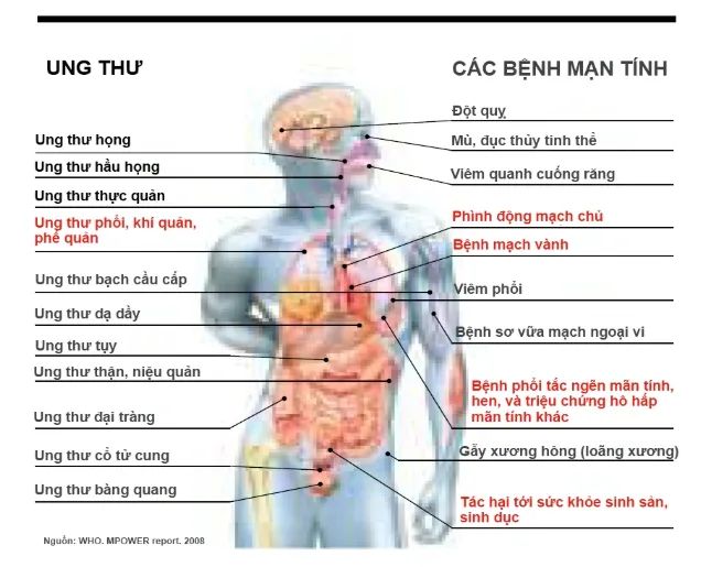 Các bệnh do hút thuốc lá gây ra