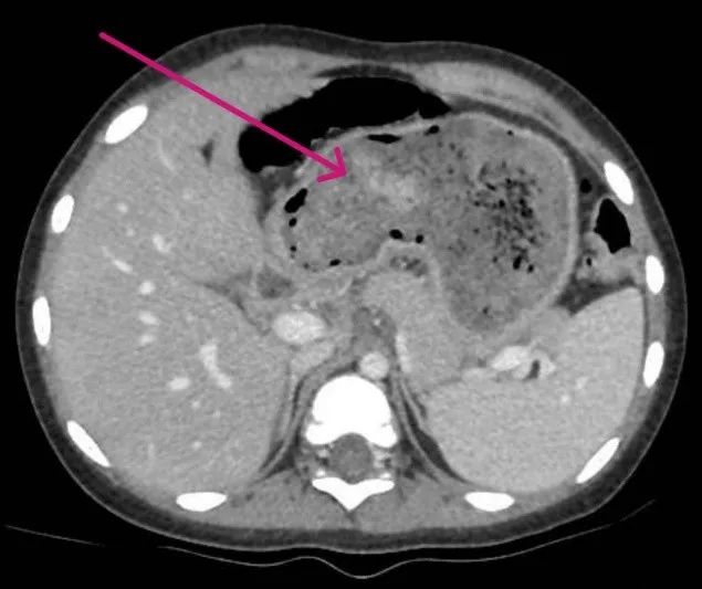 Hình ảnh scan búi tóc