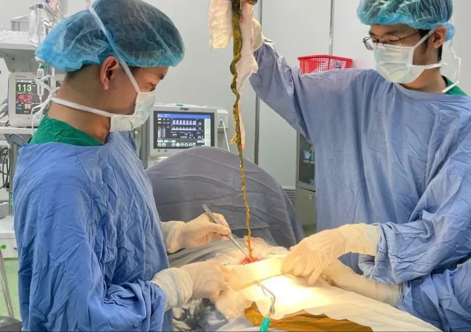 Lấy búi tóc ra khỏi cơ thể cháu bé