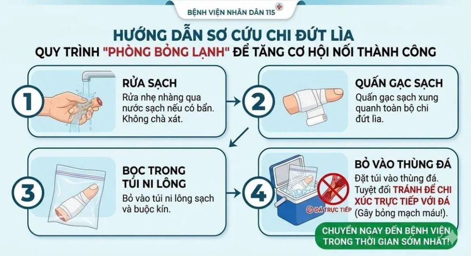 Vi phẫu nối 4 ngón tay đứt lìa vì máy cắt giấy