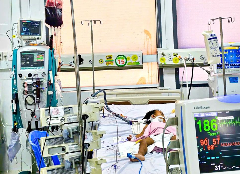 Cứu sống bé gái 20 tháng tuổi bị tay chân miệng độ 4 nguy kịch