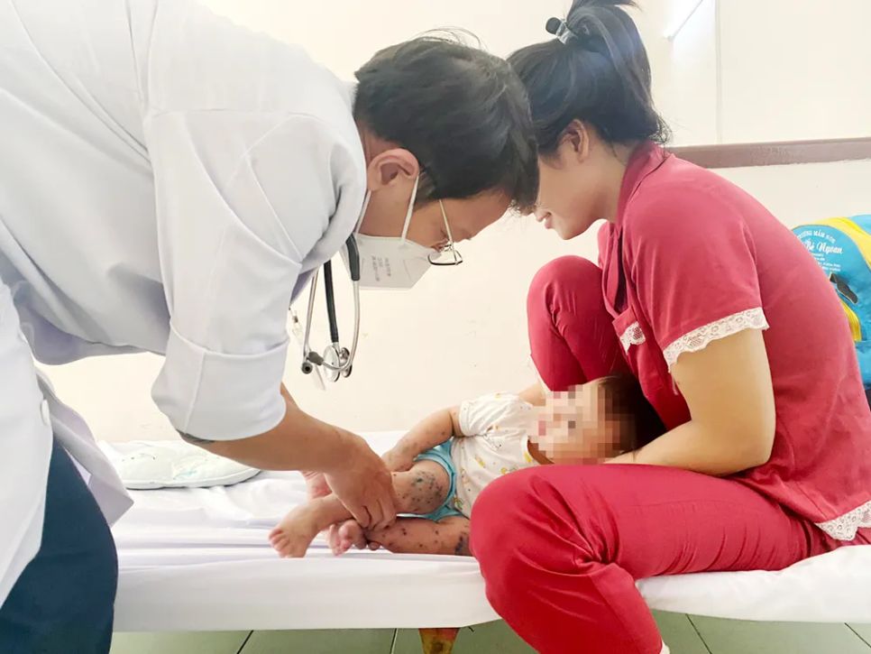 Bác sĩ Bệnh viện Nhi đồng 2 thăm khám cho bệnh nhi mắc tay chân miệng