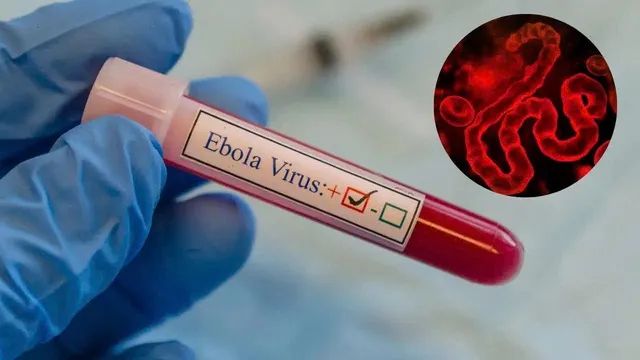 Không loại trừ virus Ebola xâm nhập qua người nhập cảnh từ vùng dịch