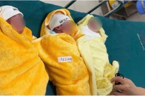 Mổ đẻ thành công ca sinh 3 bé trai hiếm gặp