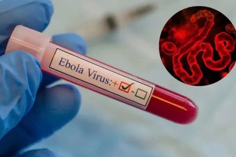 Số ca mắc và tử vong do Ebola gia tăng, công tác truy vết gặp nhiều khó khăn