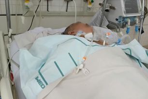 Bà cụ hôn mê do biến chứng hiếm gặp của zona thần kinh