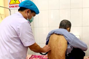 Tăng cường công tác phòng, chống bệnh lao