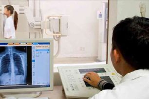 Đề nghị không áp dụng thông số thời gian chụp X-quang để thanh toán BHYT