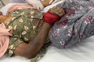 Tin thầy lang, người phụ nữ nguy kịch sau khi bị rắn cắn