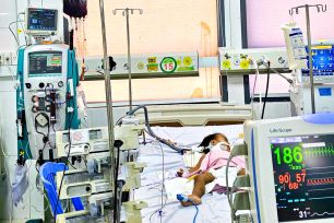 Cứu sống bé gái 20 tháng tuổi bị tay chân miệng độ 4 nguy kịch