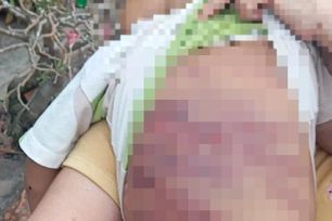 Viện kiểm sát kiến nghị cấp giấy khai sinh cho bé trai 2 tuổi bị bạo hành