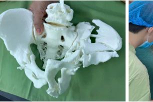 Ứng dụng công nghệ in 3D phẫu thuật thành công hai ca đa chấn thương phức tạp